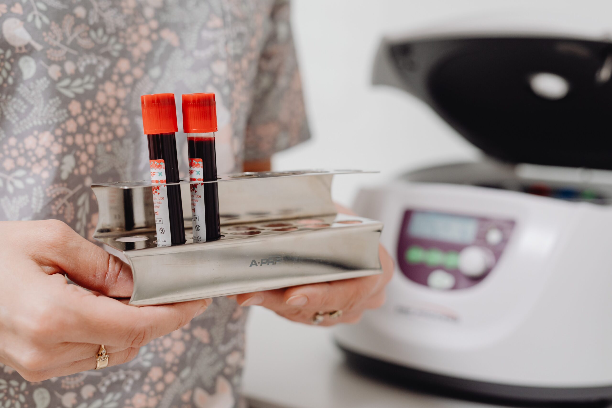 Pessoa segurando um suporte com dois tubos de sangue, ao lado de equipamento de laboratório.