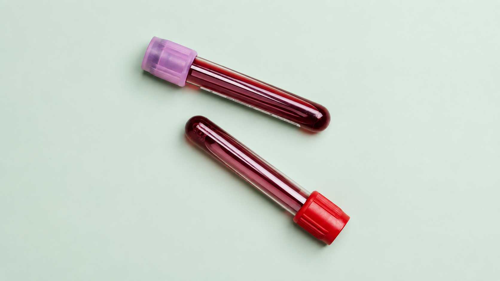 Dois tubos de amostras de sangue, com tampas roxa e vermelha, sobre uma superfície verde-clara.